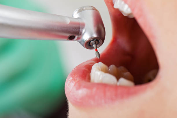 Best Emergency Treatment for Oral Infections in Plattsburgh West, NY